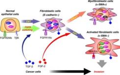 靶向TGF-β受体可有效遏制视网膜母细胞瘤侵袭