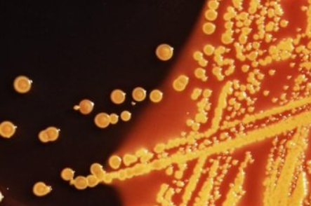 图片完美的方法来检测致命的细菌