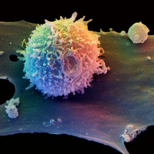 改良后的T细胞可以选择性地附着在脑瘤血管上