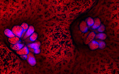 荧光可以帮助诊断生病的珊瑚