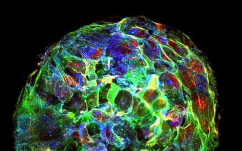 癌症的扩散可能取决于奇怪,新发现的流体物理