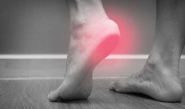 足底筋膜炎:原因、症状和治疗