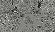 生物学家发现源促进肿瘤细胞药物敏感性的源头