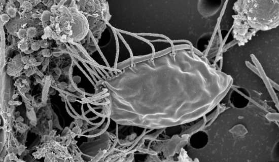 毛茸茸的食人魔 微生物可能在生命之树上代表完全新的分支