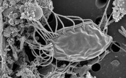 毛茸茸的食人魔 微生物可能在生命之树上代表完全新的分支