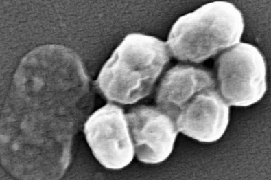研究表明细菌改变他们的表面增加抗生素耐药性
