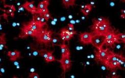 科学家发明新方法更有效地生成大脑干细胞