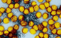 Zika病毒和黄色黄热病疫苗