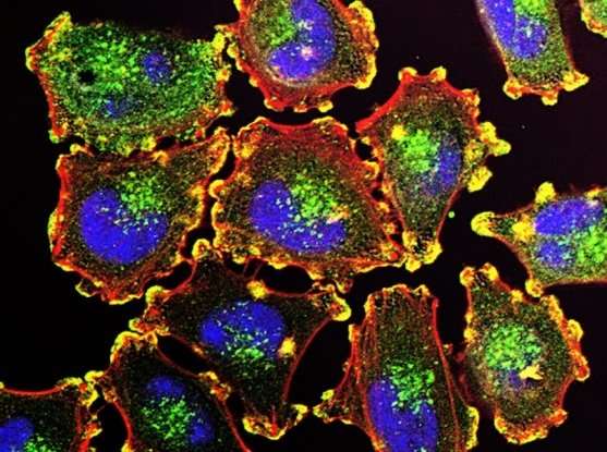 新发现的一类分子可能促进癌症疫苗的发展