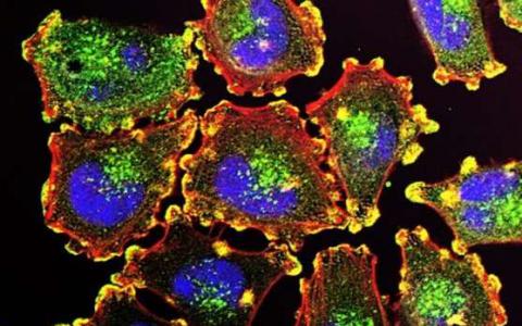 新发现的一类分子可能促进癌症疫苗的发展
