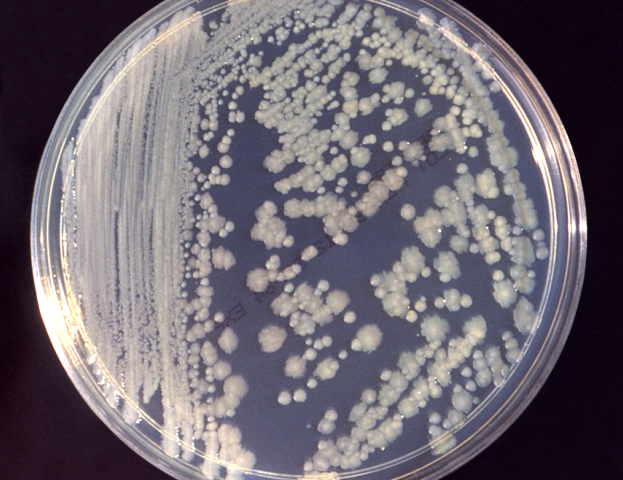 ISS微生物应该避免威胁宇航员的健康