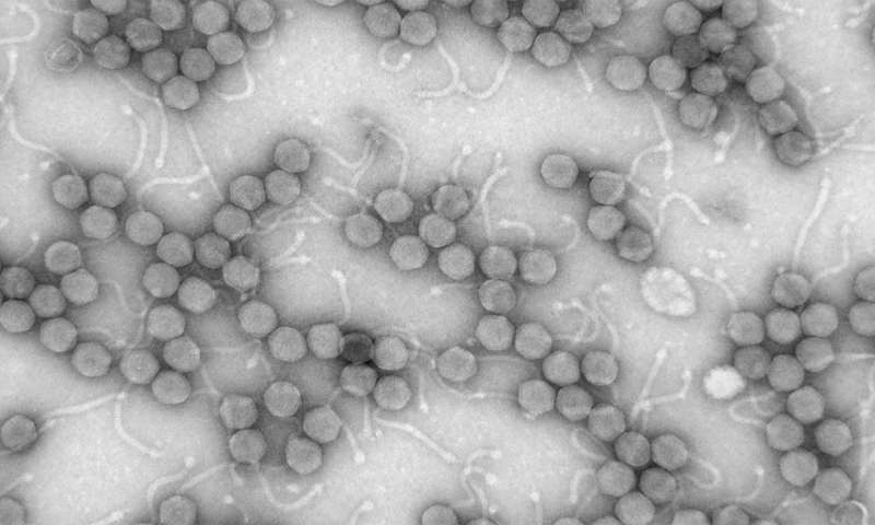 研究人员发现病毒和炎症性肠病之间的联系