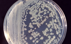 ISS微生物应该避免威胁宇航员的健康