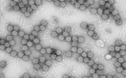 研究人员发现病毒和炎症性肠病之间的联系