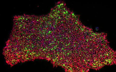 研究开发一种新的方法将皮肤细胞转化为多能干细胞