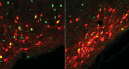 有助于控制饥饿的神经细胞已经在小鼠中被识别出来了