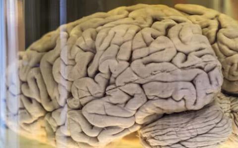 为什么我们的大脑会折叠？