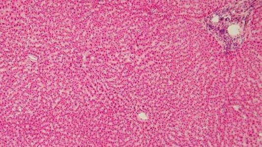 利用干细胞替代血吸虫诱导的肝纤维化中受损的肝细胞