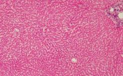 利用干细胞替代血吸虫诱导的肝纤维化中受损的肝细胞