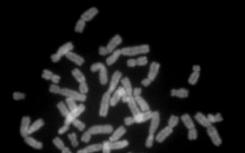 发现结构蛋白X染色体失活的重要因素