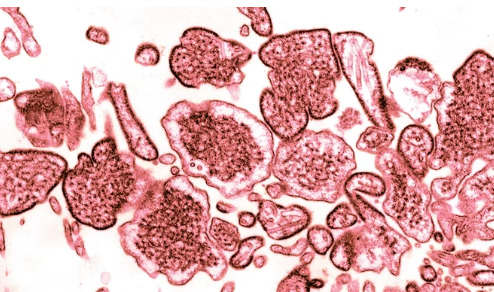 什么是Nipah病毒？印度爆发至少10人死亡