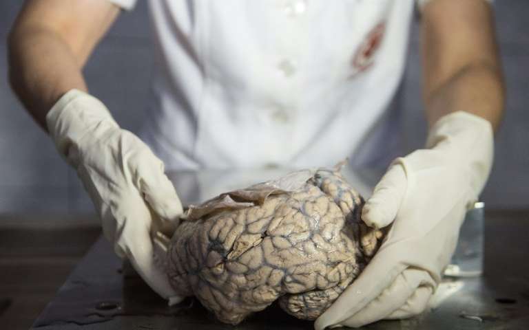 人类的大脑如何成为如此之大