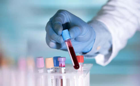 验血可以检测10种癌症 但它是否准备好迎接黄金时段？