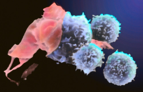 具有干细胞特性的T细胞显示出基因治疗的潜力