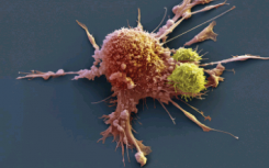 如何使癌症的CAR-T细胞治疗更安全更有效