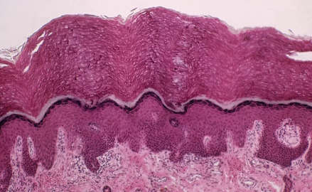 认识你的Interstitium 一个新发现的'器官'