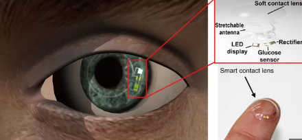 隐形眼镜可以监测糖尿病患者的葡萄糖