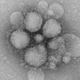 MERS疫苗正在寻求新的病毒爆发