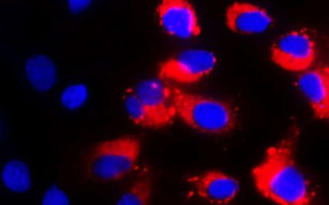 研究infection-dodging干细胞病毒性疾病新策略