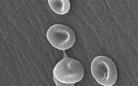 展望未来的基因来解释血液细胞的命运