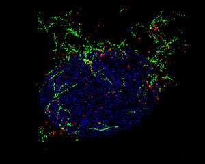 微管锚定蛋白在肌肉细胞细胞核核膜位置
