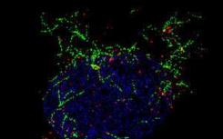 微管锚定蛋白在肌肉细胞细胞核核膜位置