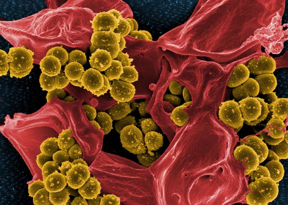 研究人员发现新的抗生素抗性基因
