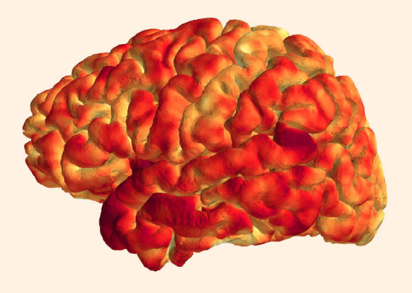 科学家发现免疫系统记忆和脑结构之间的联系