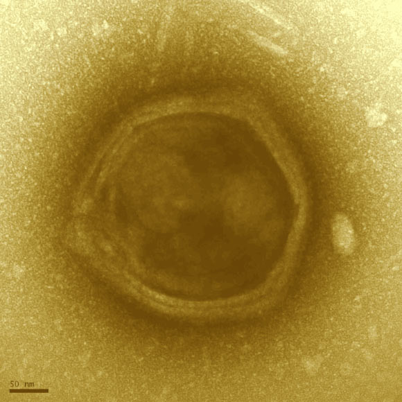 发现新的巨型病毒群