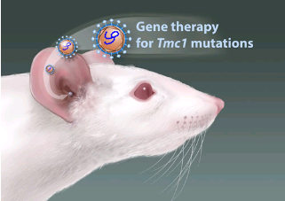 基因治疗与听力损失的生物治疗
