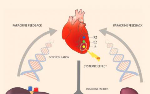 科学家说心脏病发作是“全身”状态