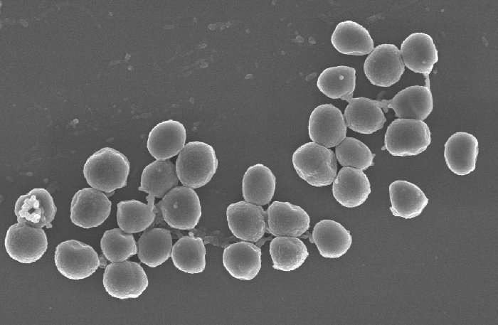 科学家发现抗击抗生素的潜在武器