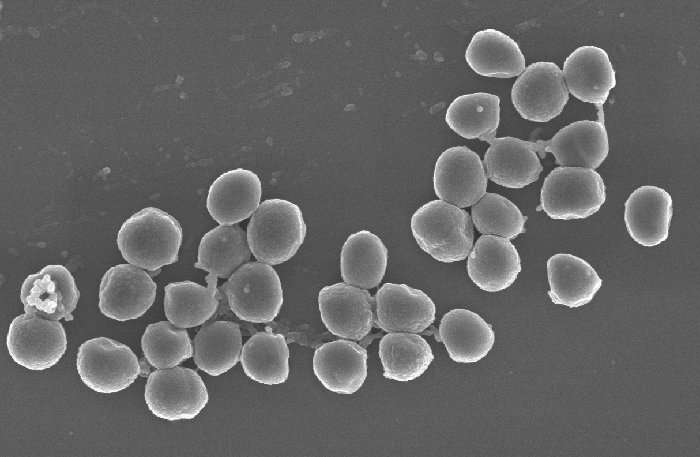 科学家发现抗击抗生素的潜在武器