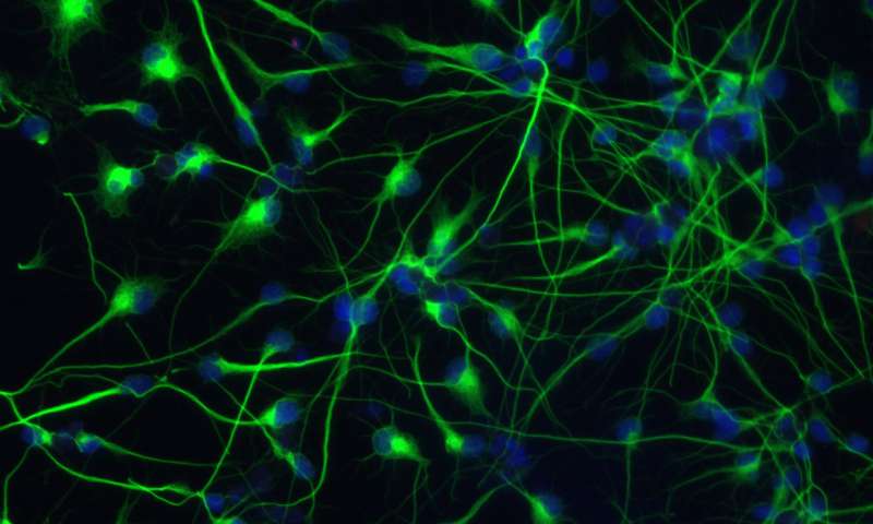 发现改善神经元工厂   干细胞身份的新调节剂