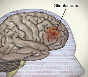 TCGA对胶质母细胞瘤肿瘤基因组的研究揭示了新的细节