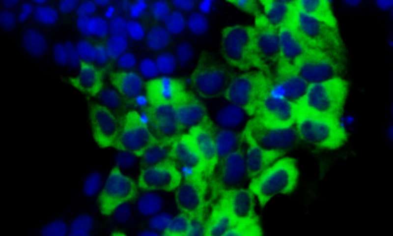 蛋白质TAZ向干细胞发送混合信号