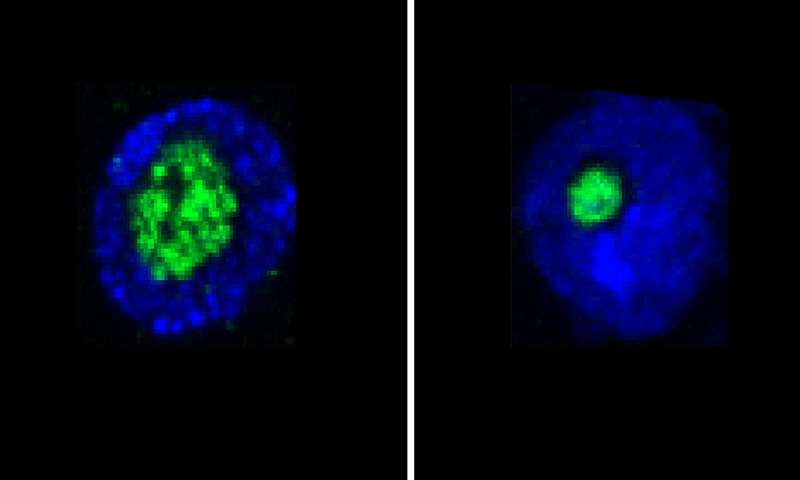 Nucleolus是预期寿命的预测因子