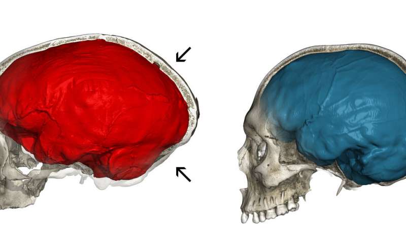 穴居人基因揭示现代人类大脑的独特的方面