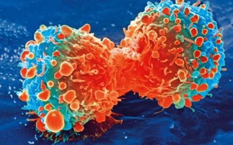 开拓性的研究癌症的新陈代谢