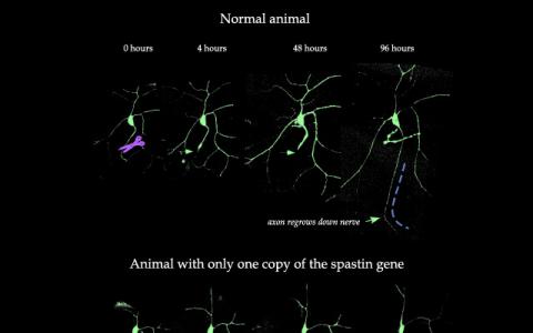 科学家确定神经再生所需的基因